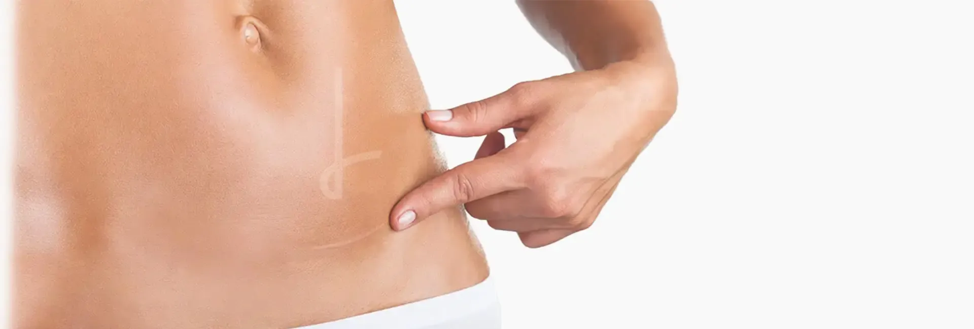 Cicatrização na cirurgia plástica: cuidados essenciais